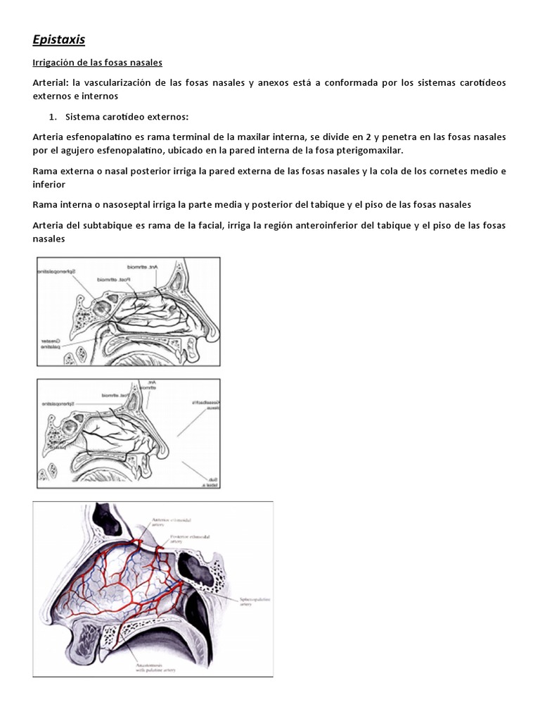 Epistaxis PDF