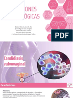 Infecciones en Ginecología