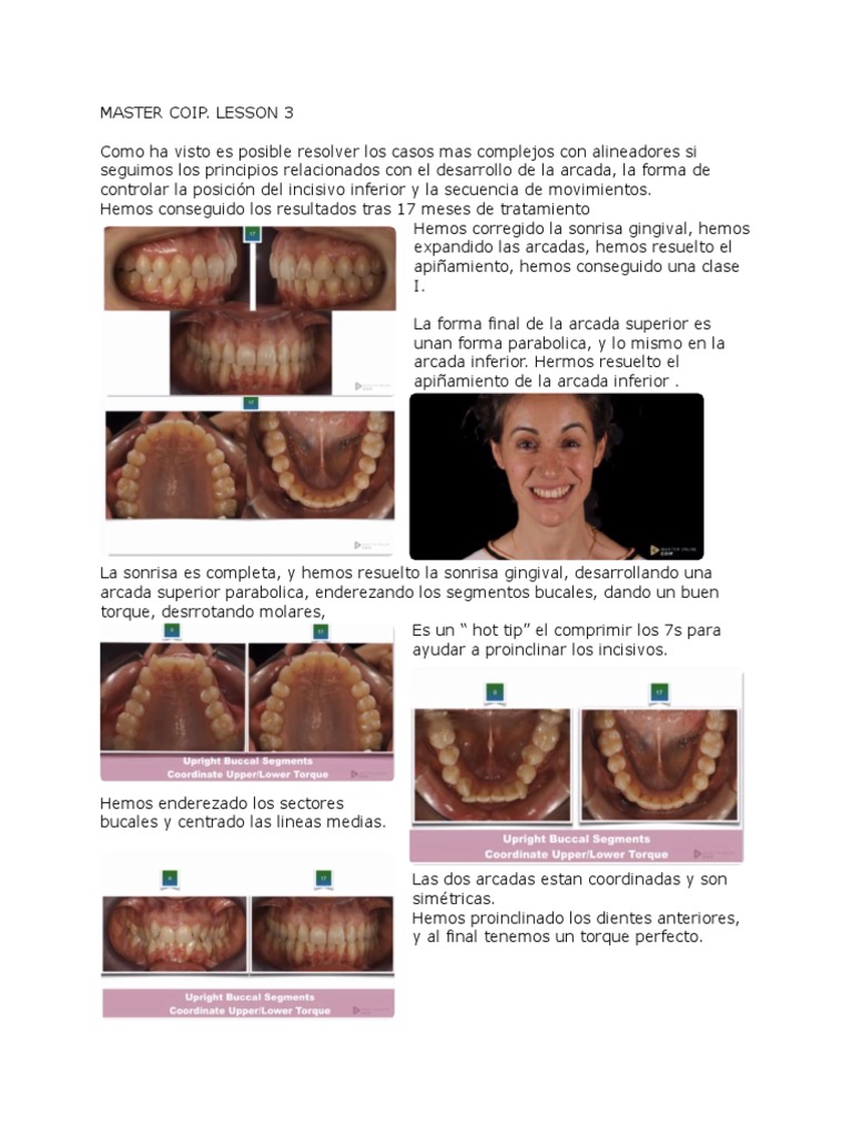 Master Coip. Lesson 3 | PDF