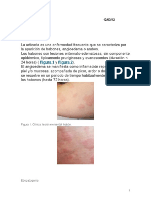 Sarna - Trastornos dermatológicos - Manual MSD versión para profesionales