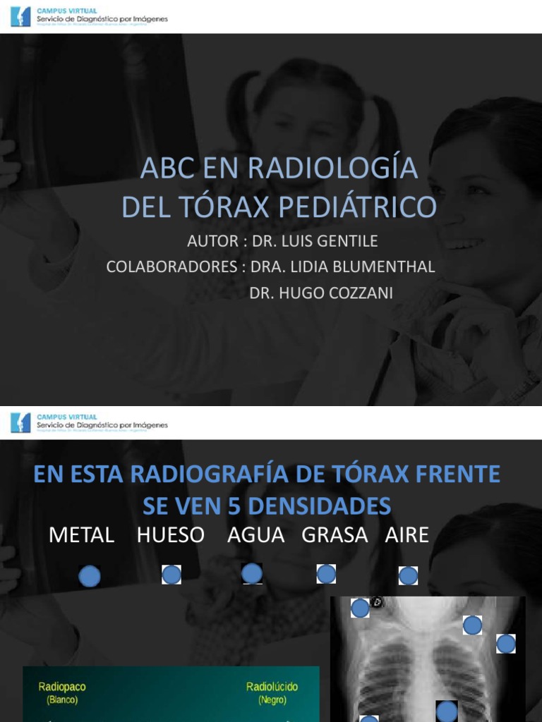 ABC RADIOLOGiA Torax pediatricoPPT | PDF | Neumonía | Pulmón