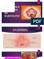 Tratamiento Glandulas de Bartolino