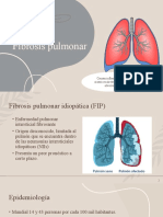 Fibrosis Pulmonar