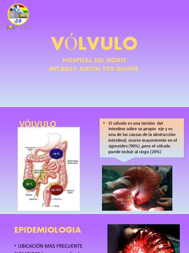 Vólvulo Intestinal: Causas y Tratamiento | PDF | Estreñimiento ...