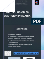 Mal Oclusion Dentincion Primaria Diana