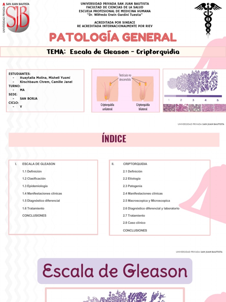 Escala de Gleason y Criptorquidia | PDF | Cancer de prostata ...