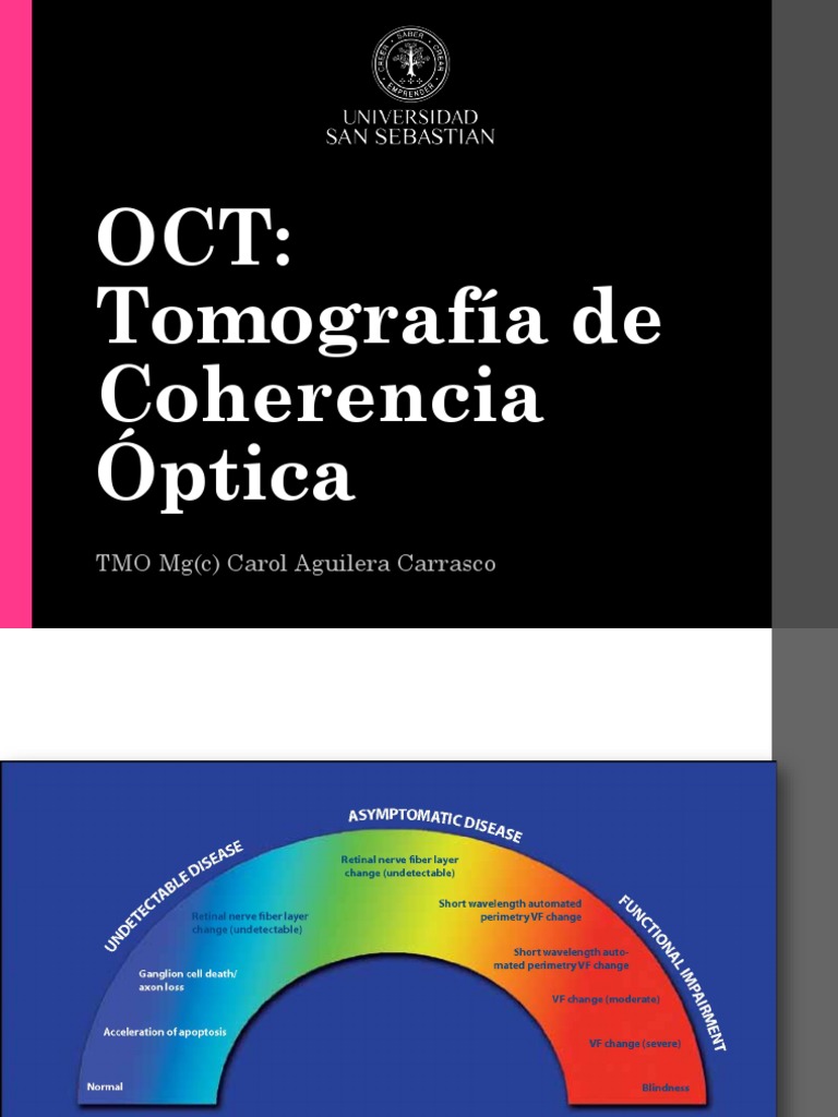 Clase 12 - OCT | PDF | Óptica | Glaucoma