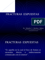 Clase 1 - FRACTURAS EXPUESTAS