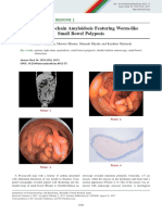 Primary Light-Chain Amyloidosis Featuring Worm-Like Small Bowel Polyposis