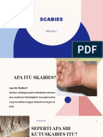 Scabies