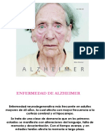 Alzheimer