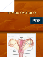 Tumor Ovárico