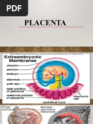 Spuria placenta cheap