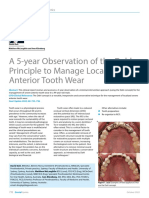 A 5-Year Observation of The Dahl Principle To Manage Localized Anterior Tooth Wear
