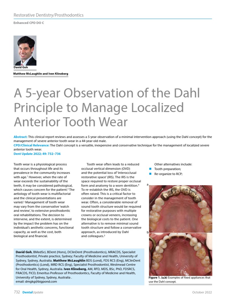 A 5Year Observation of The Dahl Principle To Manage Localized Anterior