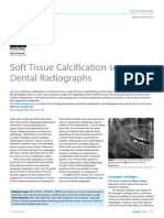 Soft Tissue Calcification Seen On Dental Radiographs
