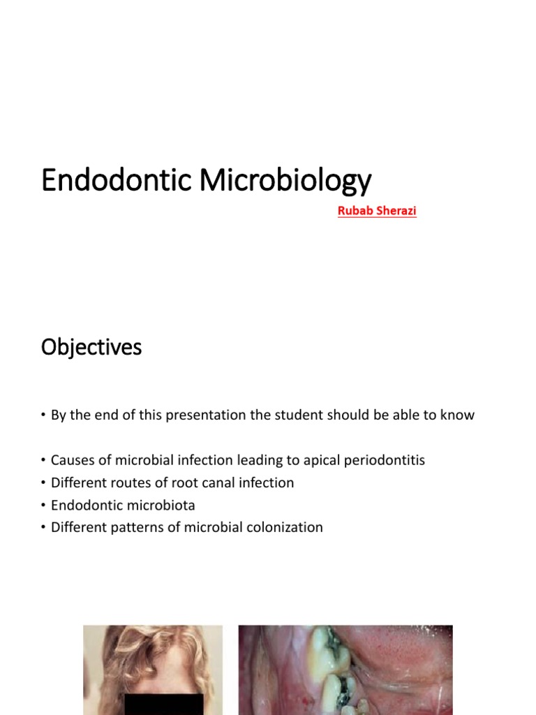 Endodontic Microbiology PDF Bacteria Infection