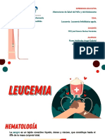 Leucemia Linfoblástica Aguda.