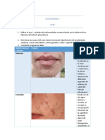 CUESTIONARIO Acne