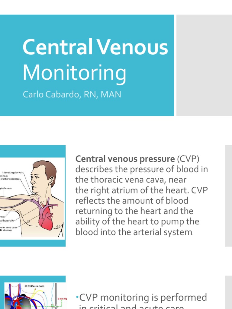 Central Venous Pressure Monitoring Guide | PDF | Heart | Vein