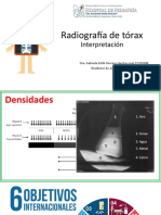 Radiografía de Tórax: Interpretación