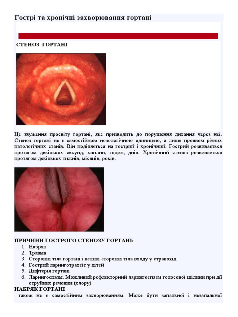 Лекція 3 Гортань | PDF