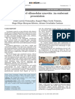 Diffuse Pigmented Villonodular Synovitis An Exuberant TAPI GA ADA TULISAN CASE REPORT