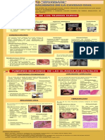 Tumores malignos de la boca: Osteosarcoma, Condrosarcoma, Sarcoma de Ewing y más