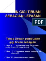 Desain Gigi Tiruan Sebagian Lepasan