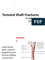 Femur Shaft Fracture