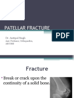 Patellar Fracture