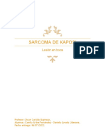Informe Sarcoma de Kaposi