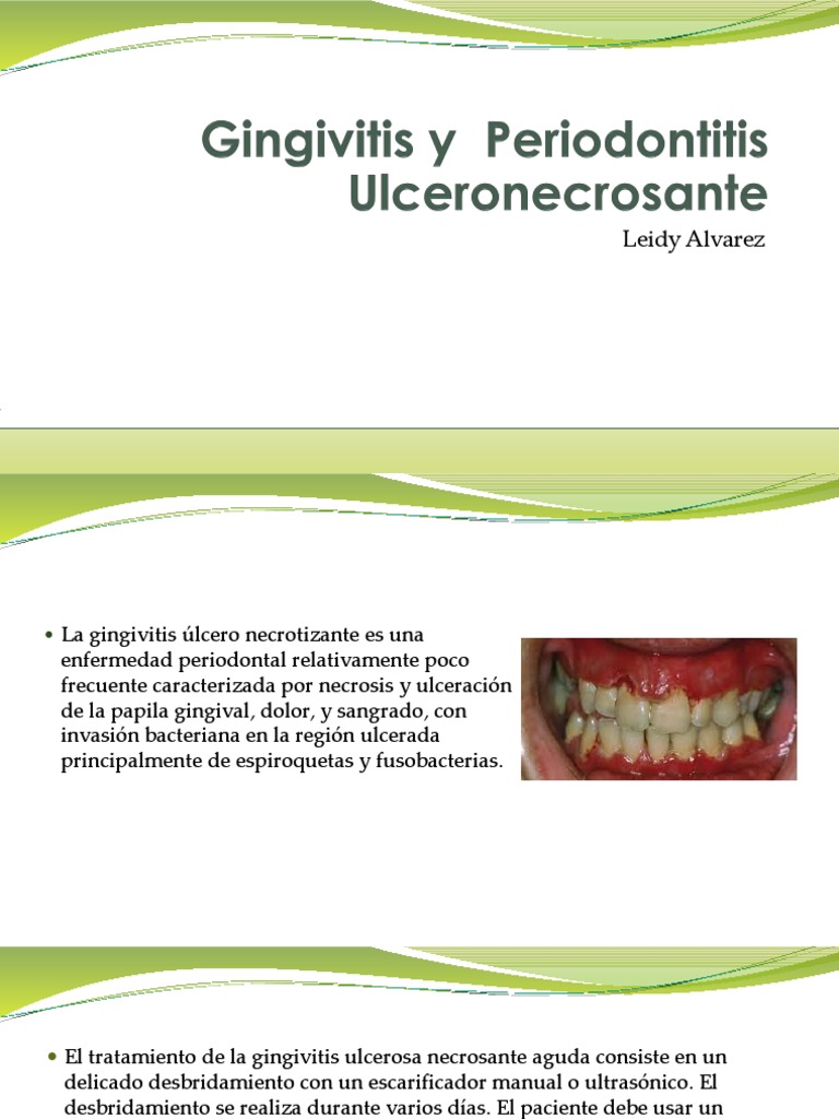 Gingivitis y Periodontitis Ulceronecrosante PDF