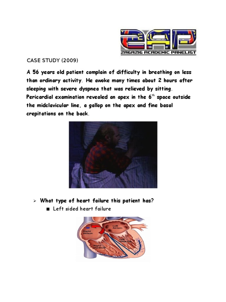 Left Sided Heart Failure Case Study PDF