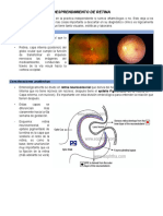 Desprendimiento de Retina
