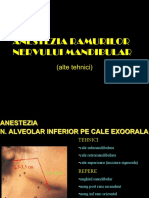 CURS 9anest N Alv Inf Lingual Bucal Complicatii LOCALE AL