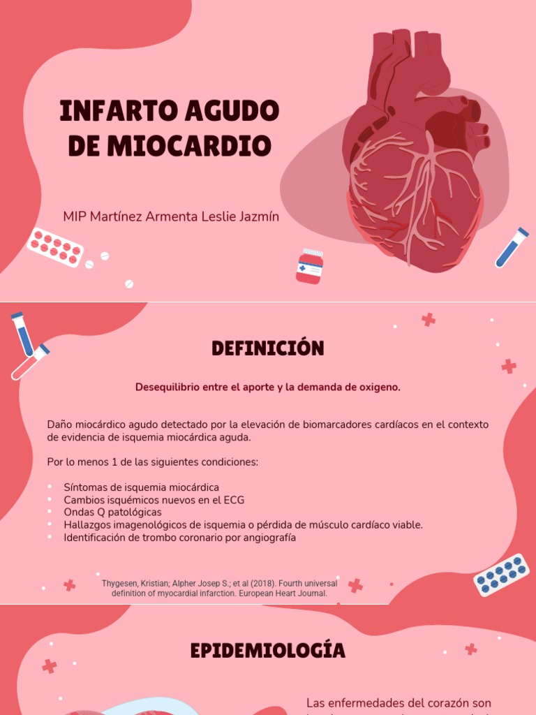 IAM Expo | PDF | Isquemia | Infarto de miocardio