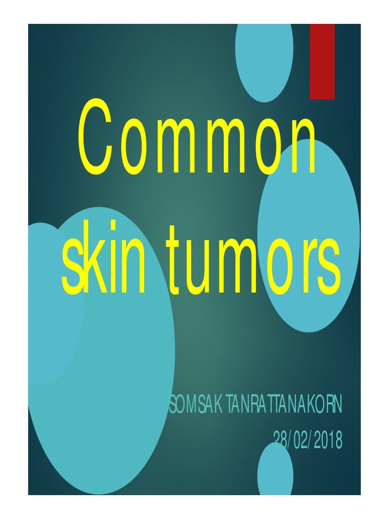 Elective61 Common Skin Tumor PDF Neoplasms Causes Of Death