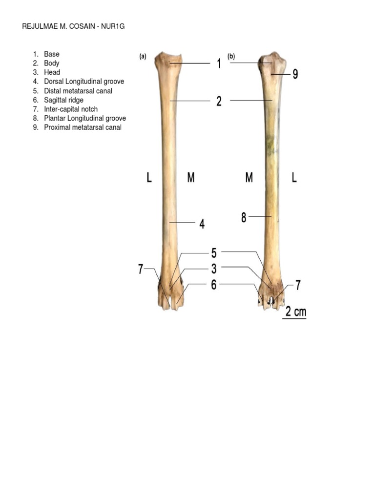 Actvity 6 Upper and LOwer Extremities PDF Anatomical Terms Of Location Human Anatomy