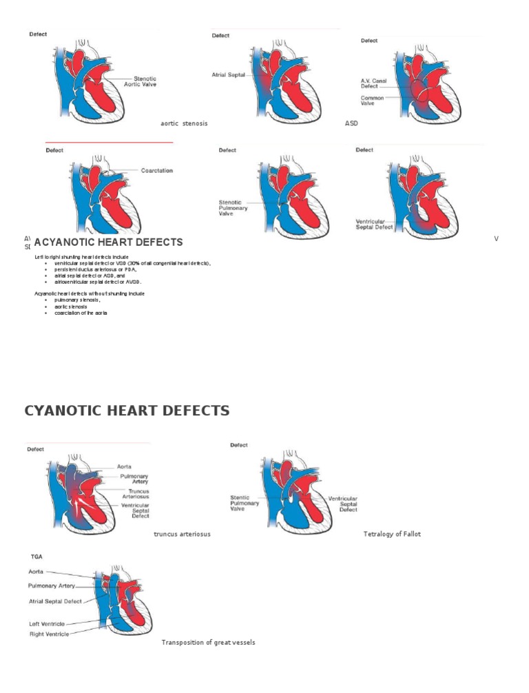 Types of Congenital Heart Defects | PDF