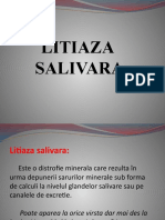 Litiaza Salivara