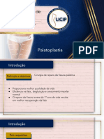 Palatoplastia