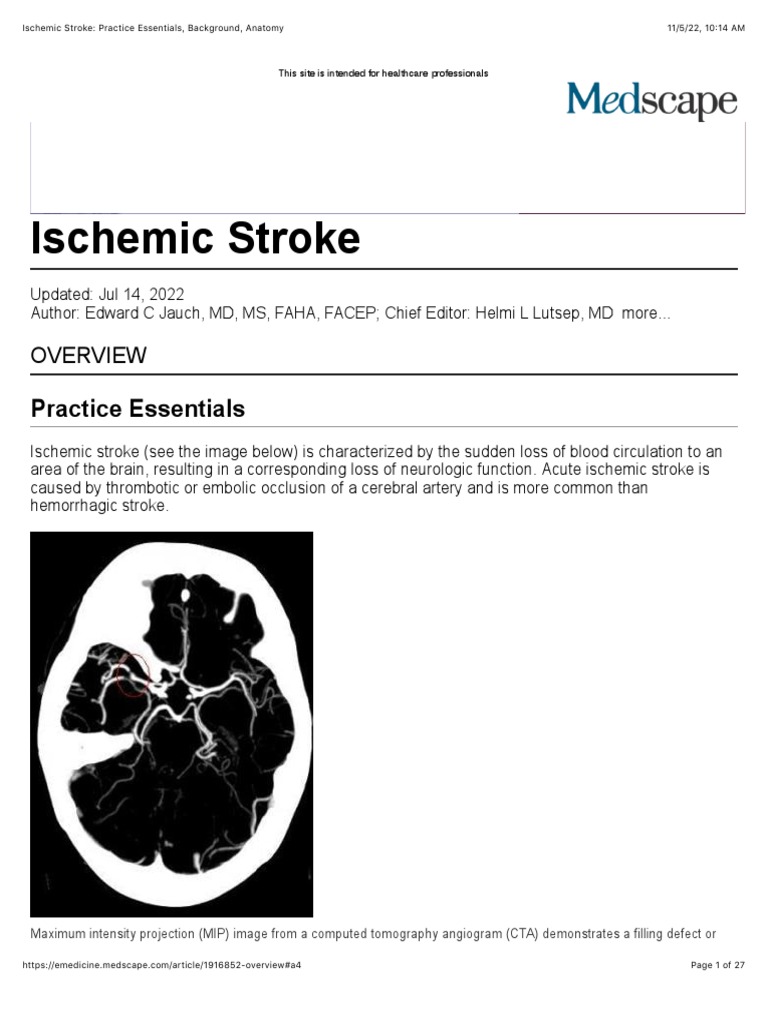 Ischemic Stroke Overview and Management | PDF | Stroke | Ischemia