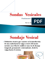 Sondas Vesicales y Sonda Nasogástrica