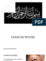 Conjucntivitis