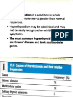 Hyperthyroidism