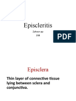 Episcleritis