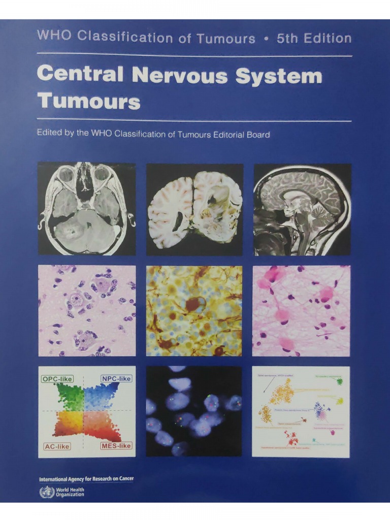 WHO - Who Classification of Tumours - Central Nervous System