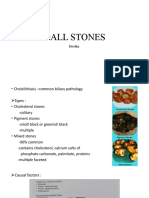 Gall Stones