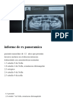 Informe Radiografico